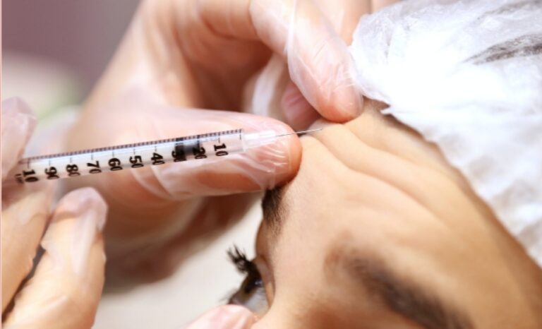 Forehead Botox For Wrinkles: How Many Units Do You Need?